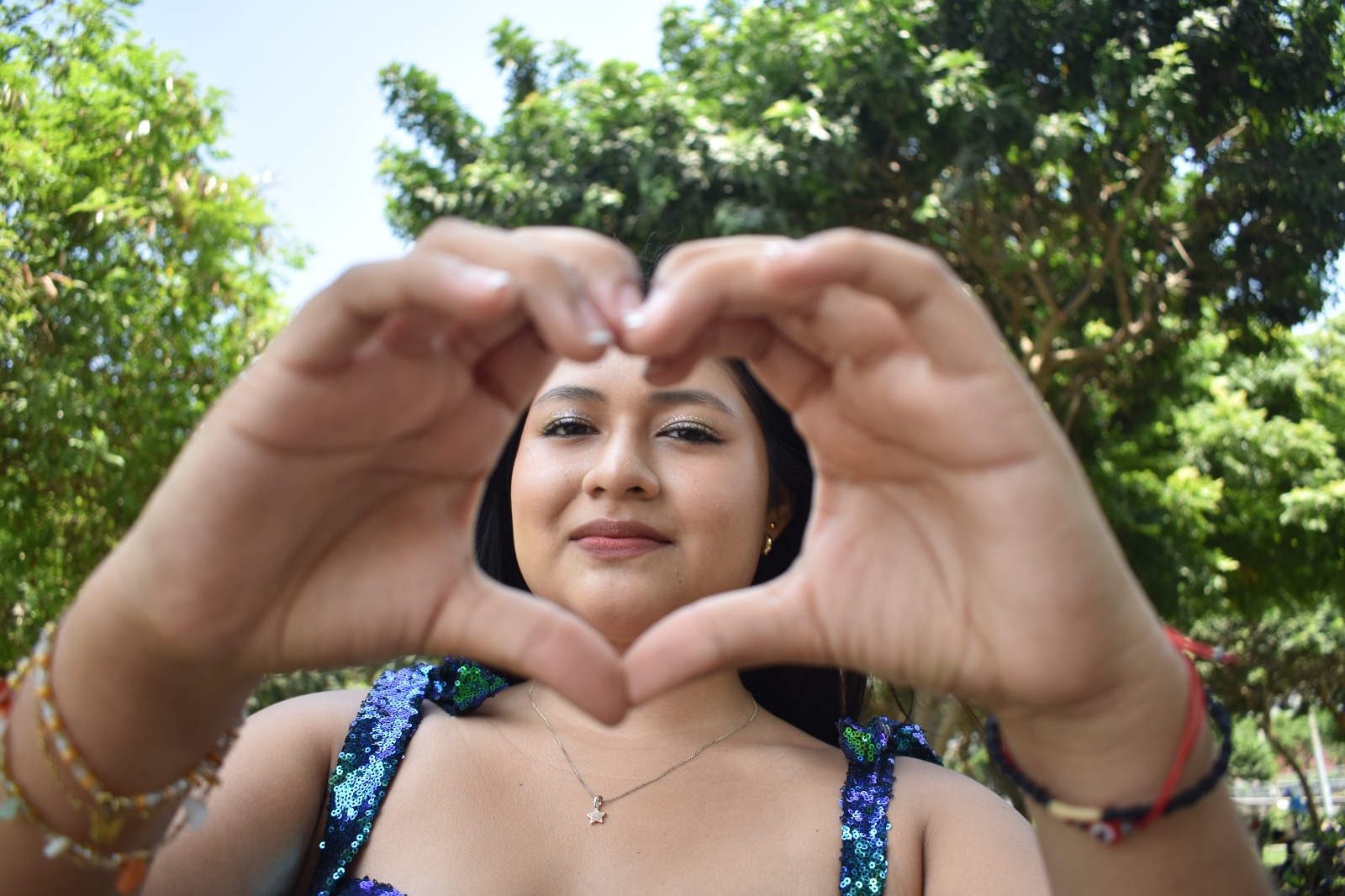 Fergie Sologastua en vivo